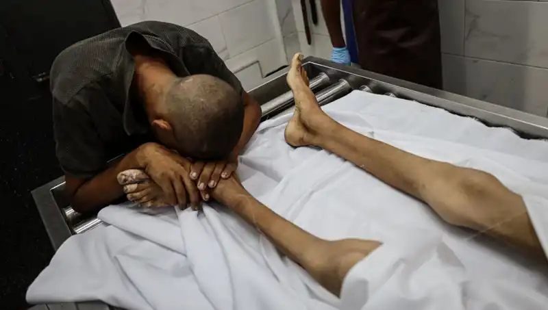 Gazze'de Açlıkla Mücadele Eden Çocuklardan Biri Daha Hayatını Kaybetti