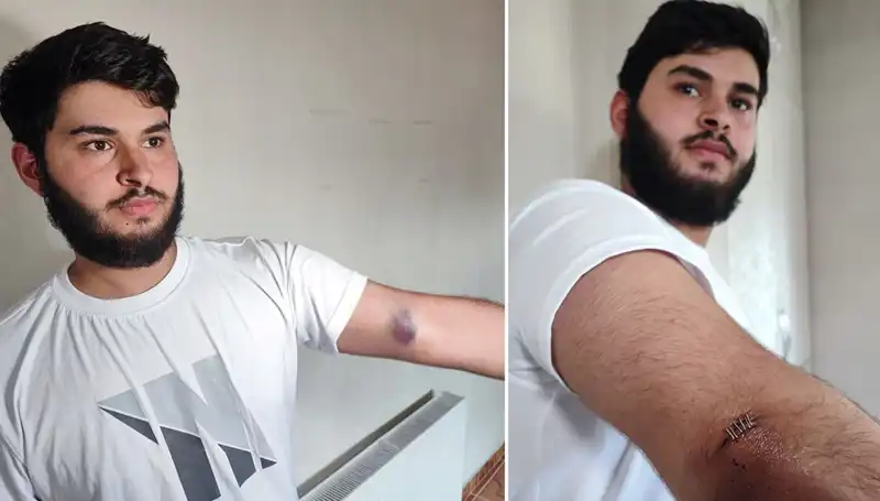 Mahallede Top Krizi: Conolar Kamyonetle Geldi, Herkes Şaşırdı!